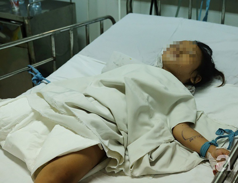 Vụ nổ hầm cầu khiến 4 người trong một gia đình bỏng nặng: Hai đứa trẻ sẽ phải mổ cắt lọc, ghép da nhiều bước